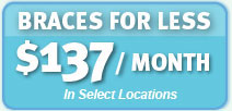 Braces for Less: $137/month in Select Locations