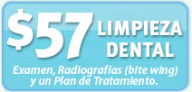$57 Limpieza Dental