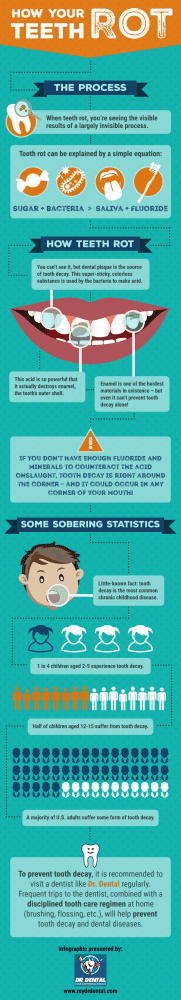 drdental-tooth-decay-infographic-1