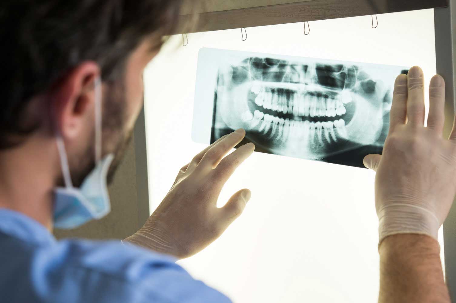 Dental Implants: An Overview