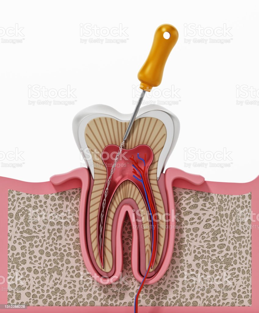 Dentures-1